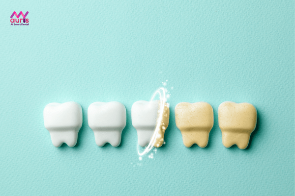 cách chữa răng ố vàng thành trắng