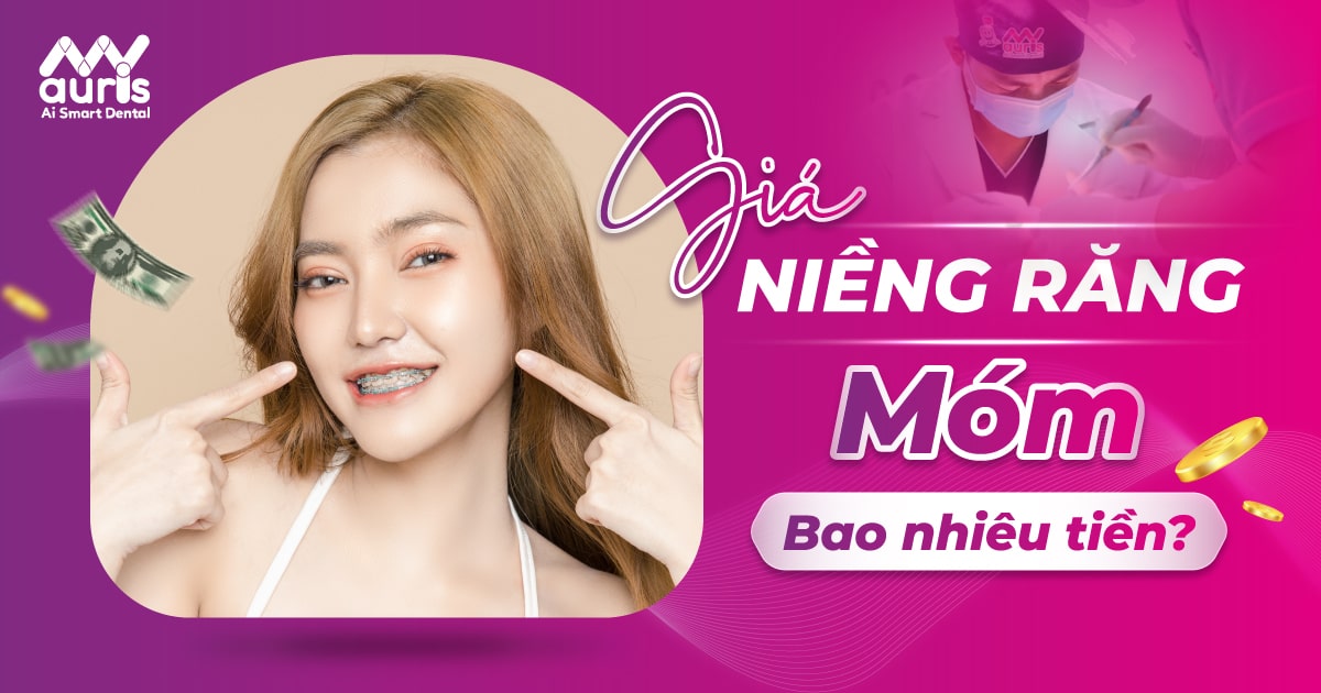 giá niềng răng móm