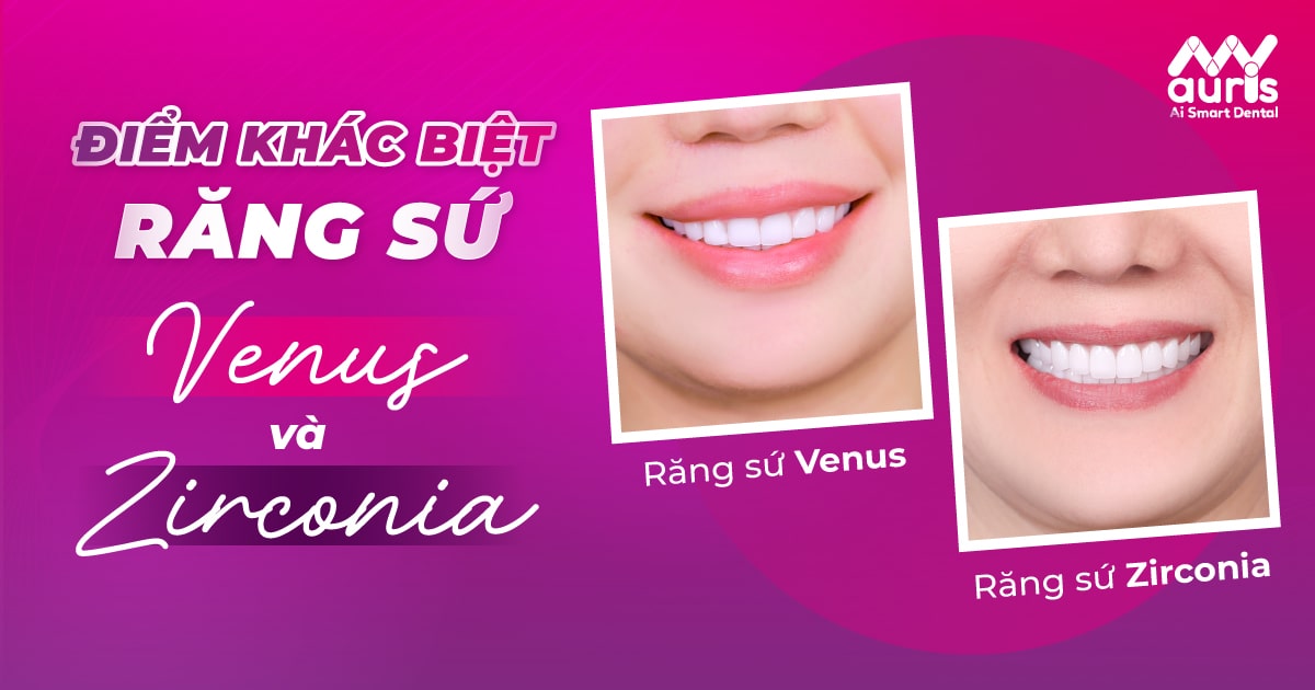 So sánh và lựa chọn giữa răng sứ venus và zirconia cho nụ cười hoàn hảo