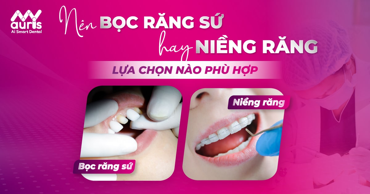 bọc răng sứ hay niềng răng