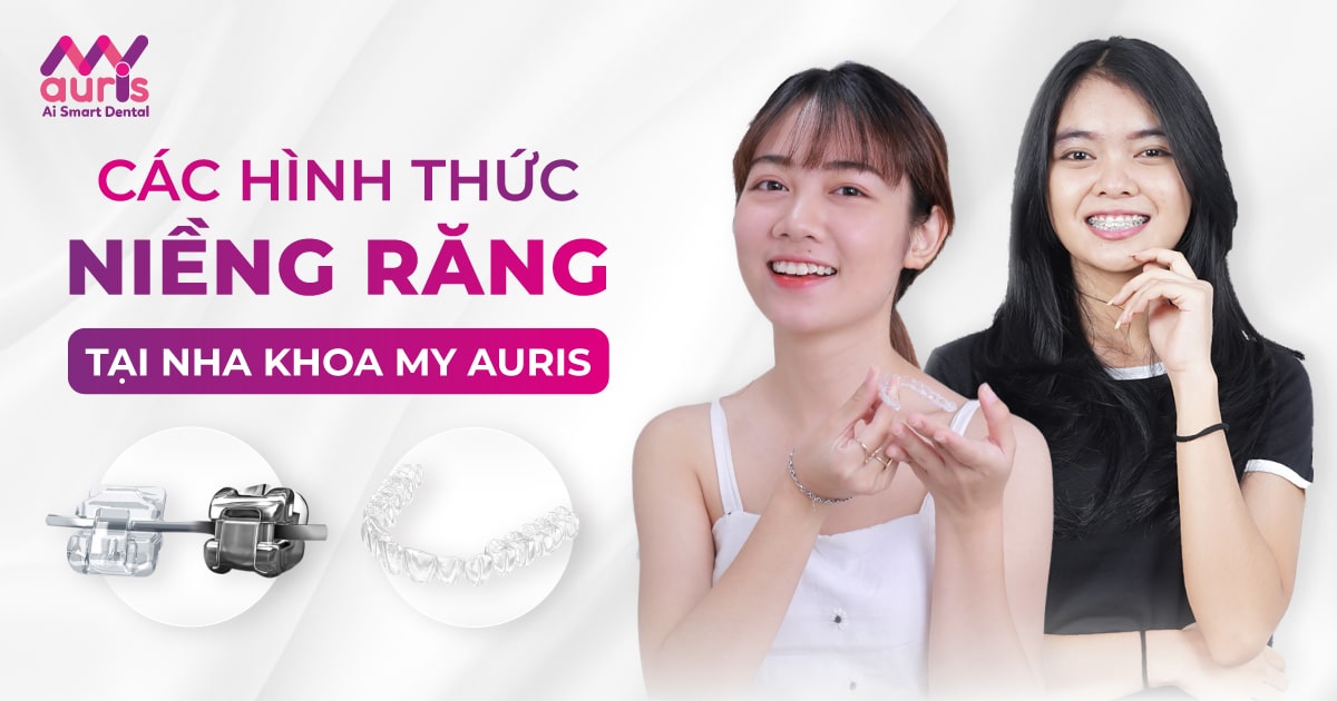 các hình thức niềng răng