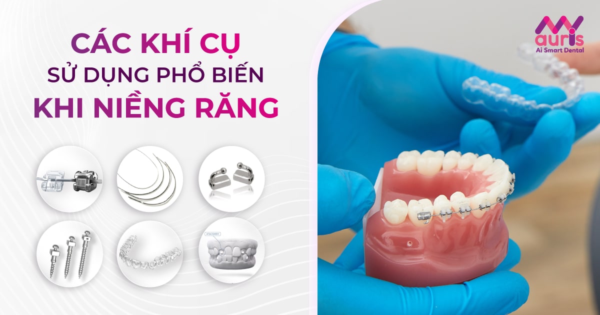 các khí cụ niềng răng