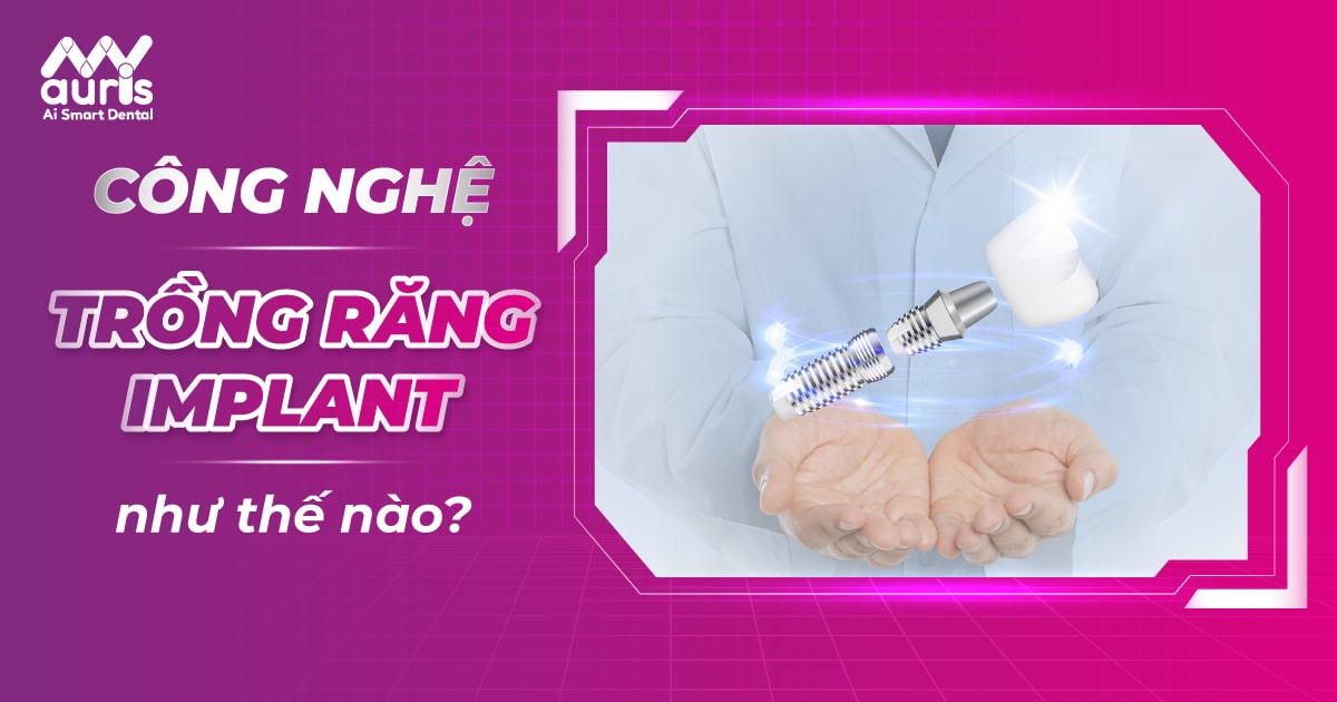 trồng răng công nghệ implant