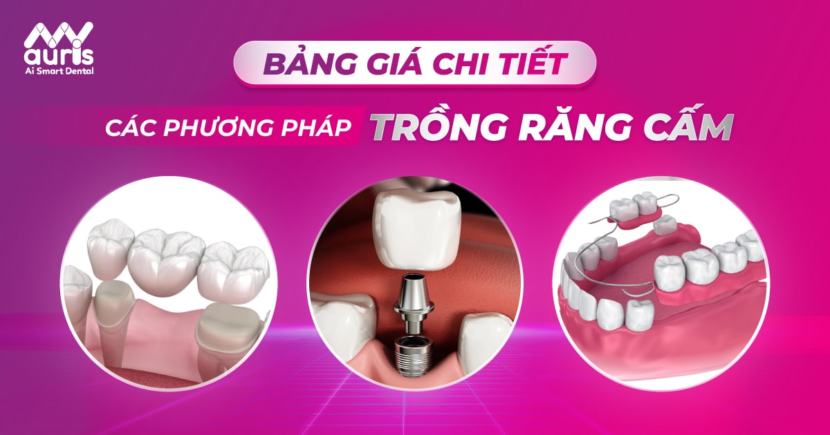 bảng giá trồng răng cấm