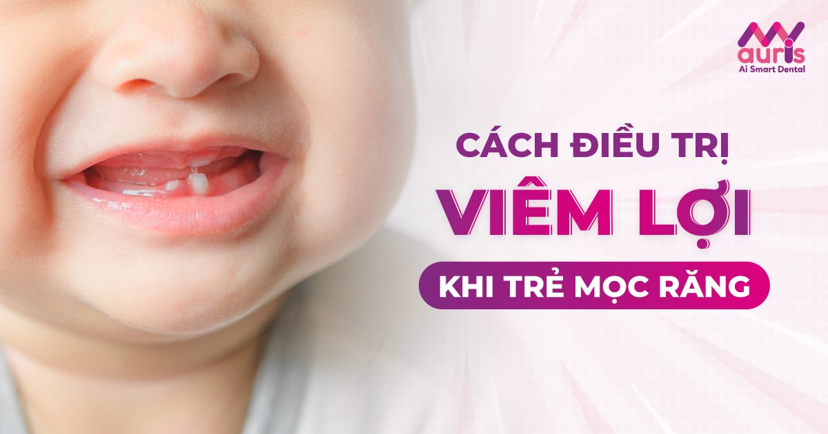 trẻ bị viêm lợi khi mọc răng