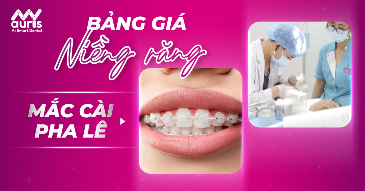 bảng giá niềng răng mắc cài pha lê