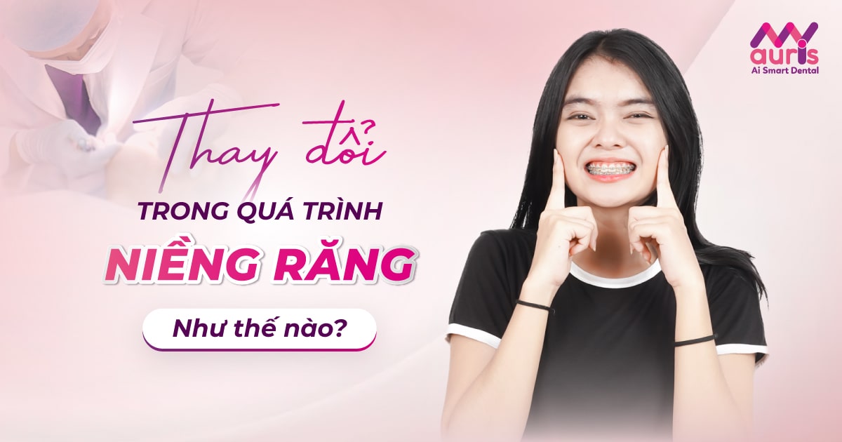 thay đổi trong quá trình niềng răng