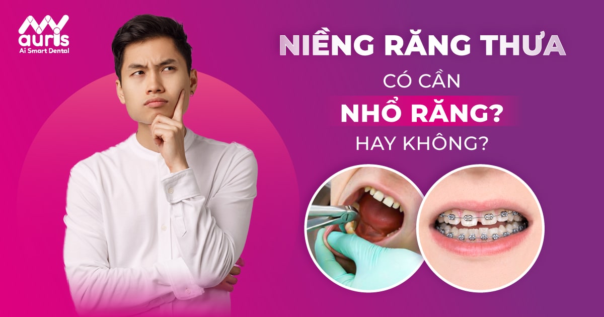 niềng răng thưa có cần phải nhổ răng không