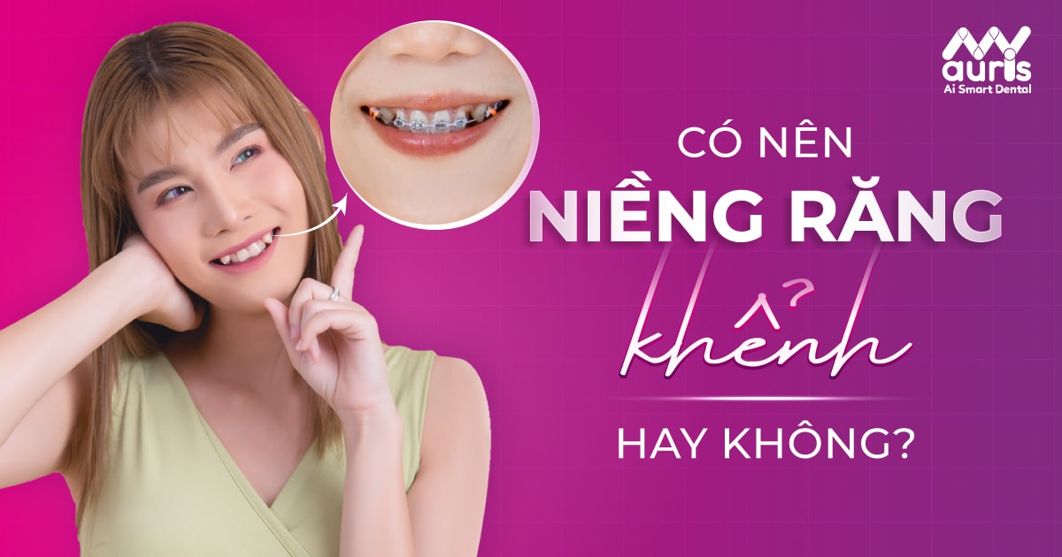 có nên niềng răng khểnh không