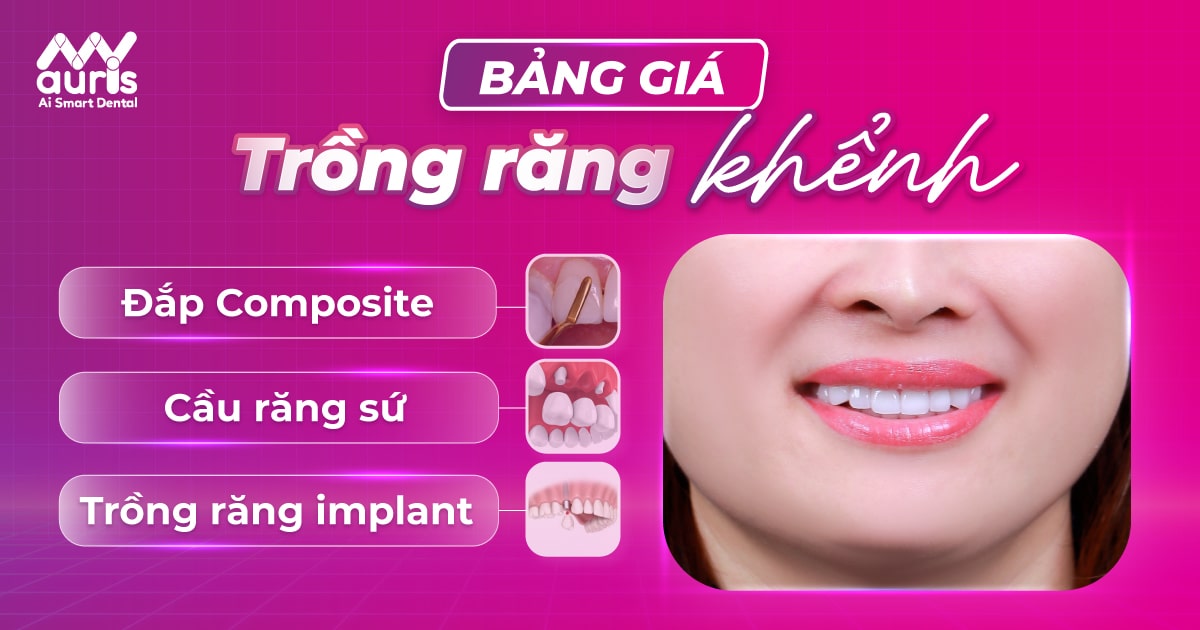 Bảng giá trồng răng khểnh từ 3 phương pháp phổ biến