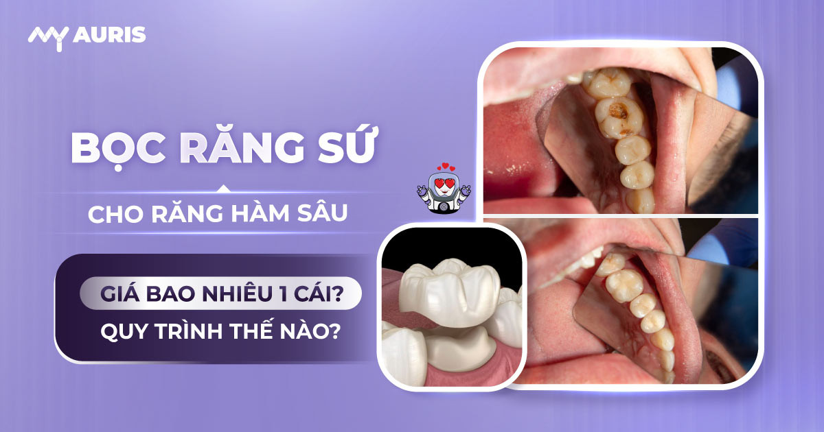 bọc răng sứ cho răng hàm sâu