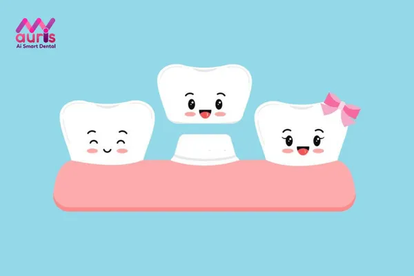 Quy trình bọc răng sứ cho răng sâu diễn ra mấy bước?
