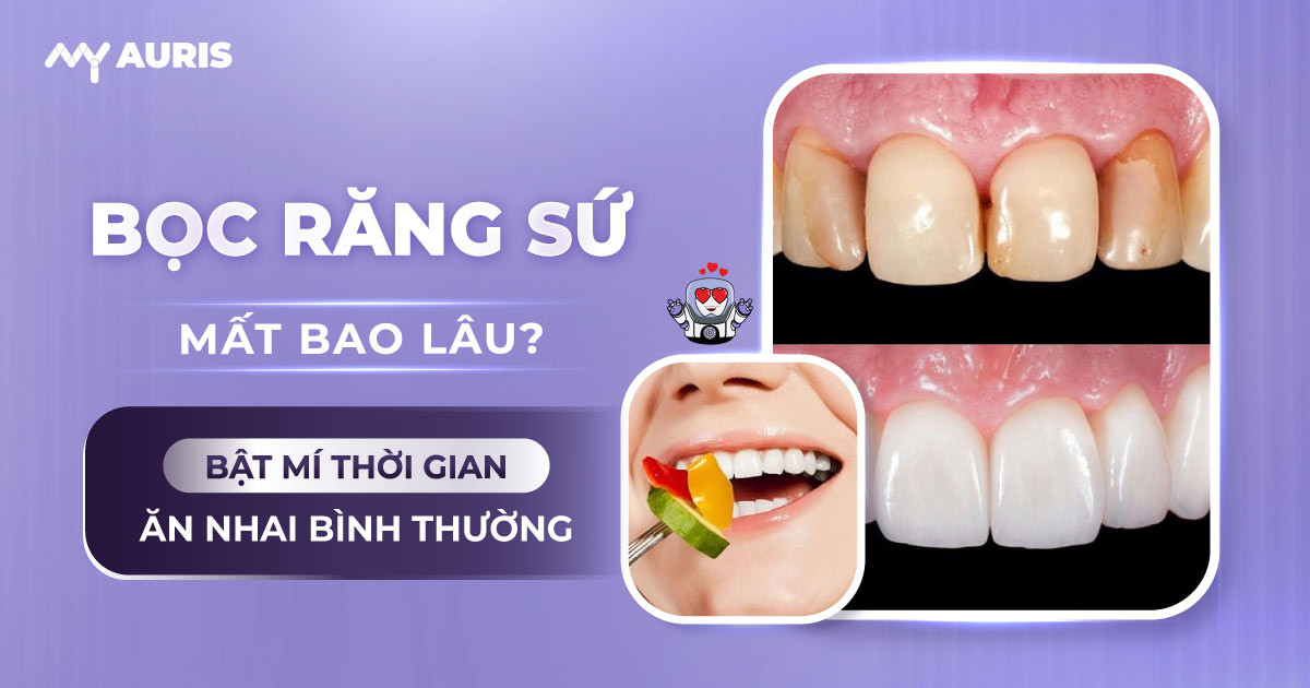 bọc răng sứ mất bao lâu ,làm răng sứ mất bao lâu,bọc 1 răng sứ mất bao lâu,quy trình bọc răng sứ mất bao lâu,bọc răng sứ mất bao lâu,làm răng sứ trong bao lâu,bọc răng sứ bao lâu thì bình thường,mài răng bọc sứ,sau khi bọc răng sứ,bọc răng sứ bao lâu thì ăn được,bọc răng sứ bao lâu thì phải làm lại,gắn răng tạm sau khi mài răng,bọc răng sứ bao lâu phải làm lại,bọc răng sứ thời gian được bao lâu,sau khi bọc răng sứ nên làm gì,quy trình bọc răng sứ cho răng cửa,quy trình bọc răng sứ,phục hồi răng sứ,mài răng làm răng sứ,làm cầu răng sứ mất bao lâu,trồng răng mất bao lâu,làm răng sứ có đau không,bọc răng sứ mất bao nhiêu lâu,bọc răng sứ mất bao nhiêu ngày,bọc răng sứ mất mấy ngày,bọc răng sứ mất thời gian bao lâu,thời gian bọc răng sứ