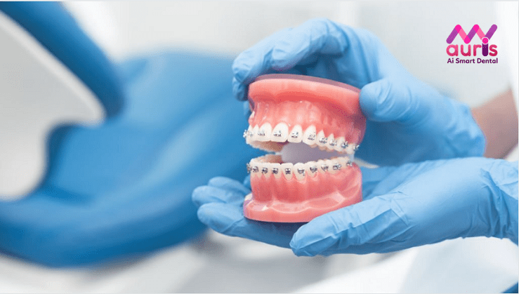các bước trong quá trình niềng răng