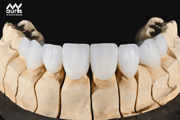 Các loại răng sứ Cercon - Răng toàn sứ Cercon Zirconia