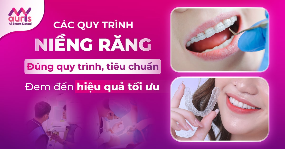 Các quy trình niềng răng