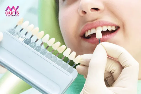 Giá tiền các loại răng sứ quá rẻ thì có nên thực hiện?