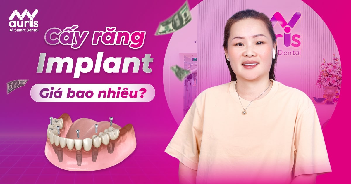 Cấy răng Implant giá bao nhiêu tiền? Cách chọn nha khoa