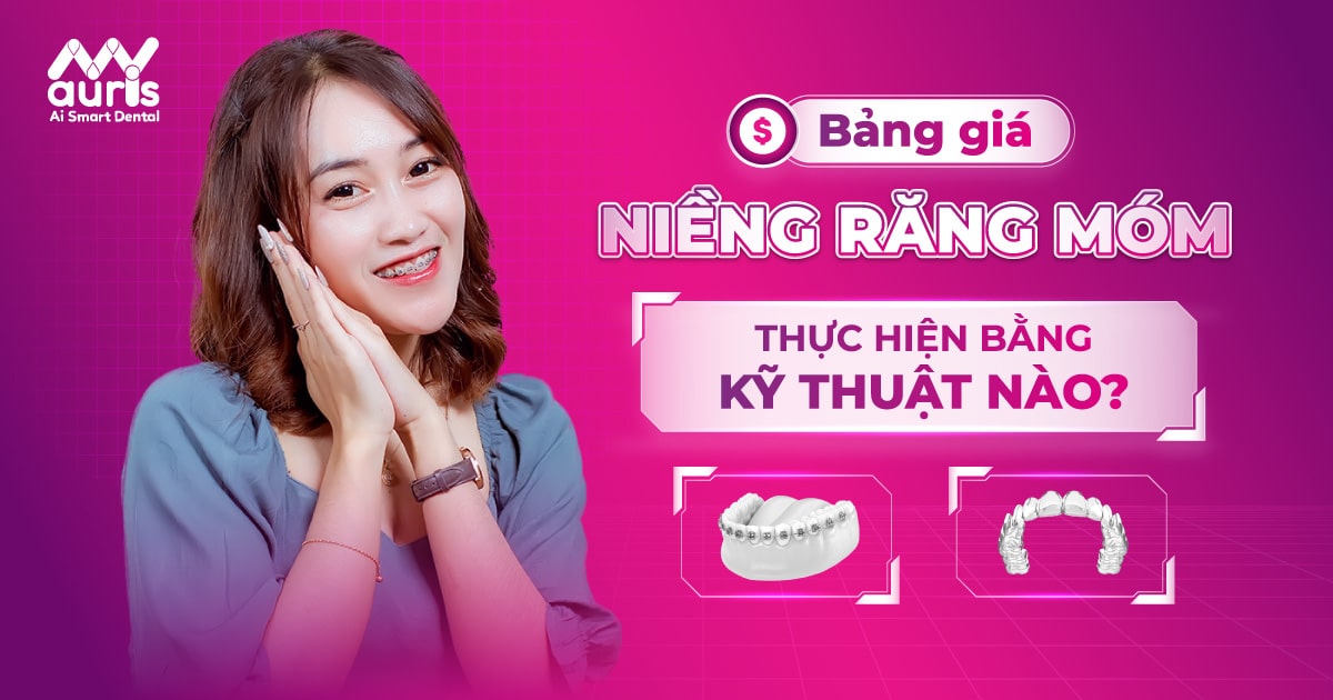 Tìm hiểu chi phí niềng răng móm với 2 kỹ thuật chính