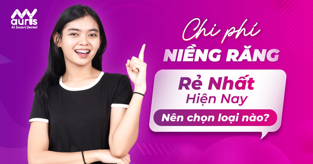 Chi phí niềng răng rẻ nhất hiện nay