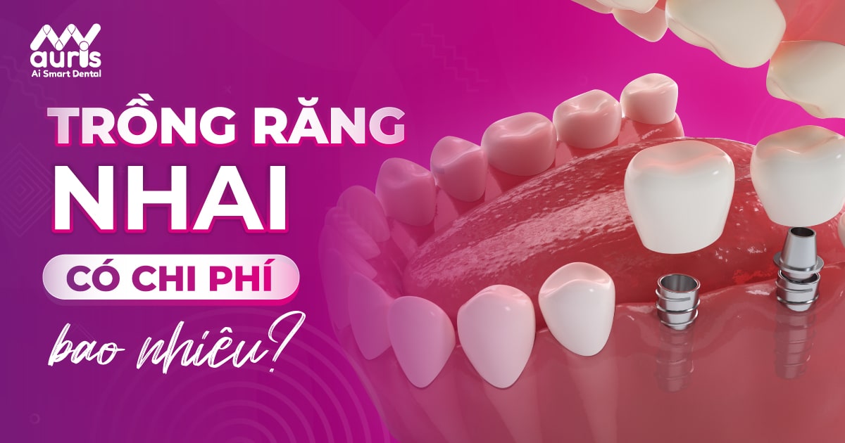 2 phương pháp trồng răng nhai có chi phí bao nhiêu?