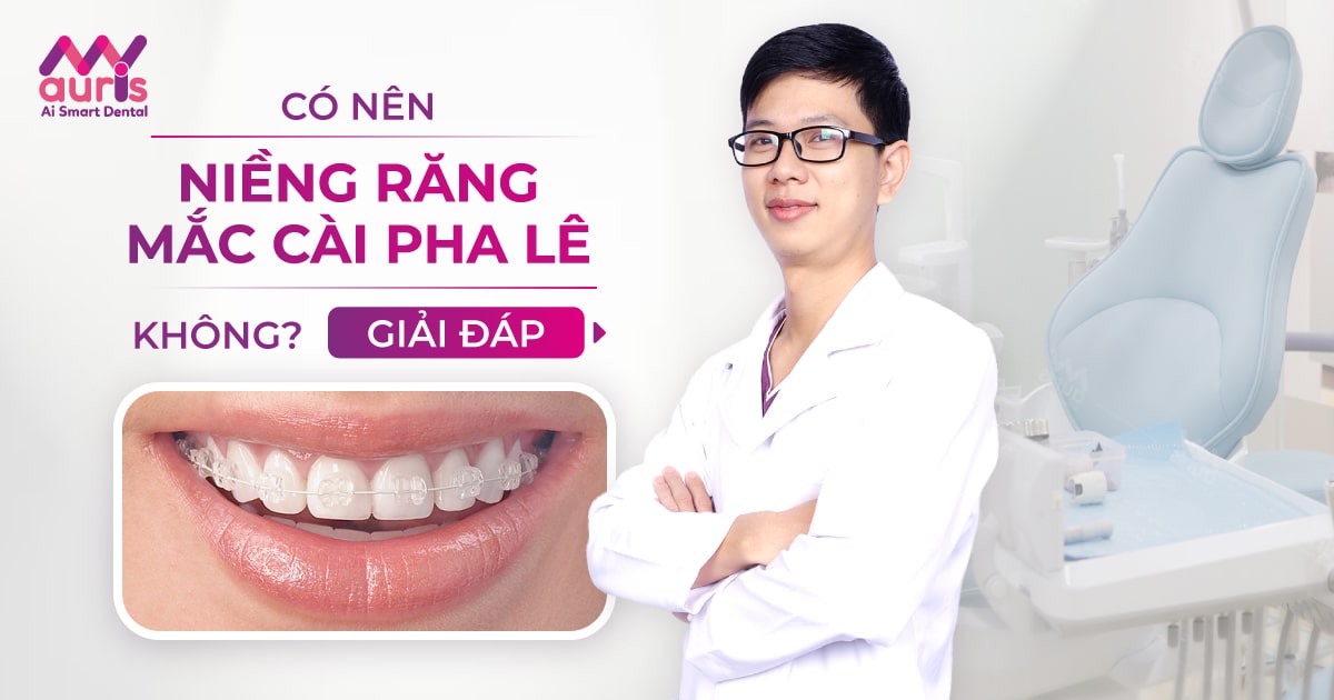 Có nên niềng răng mắc cài pha lê không (5 lý do giải đáp)