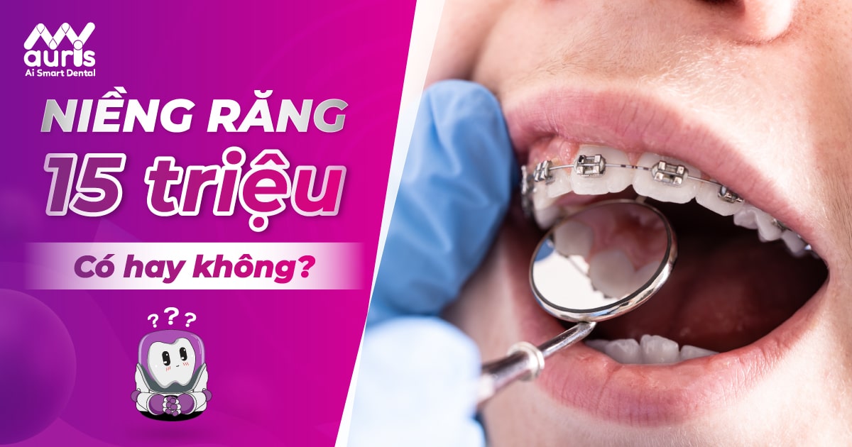 Giá niềng răng niềng răng 15 triệu ở các phòng khám nha khoa