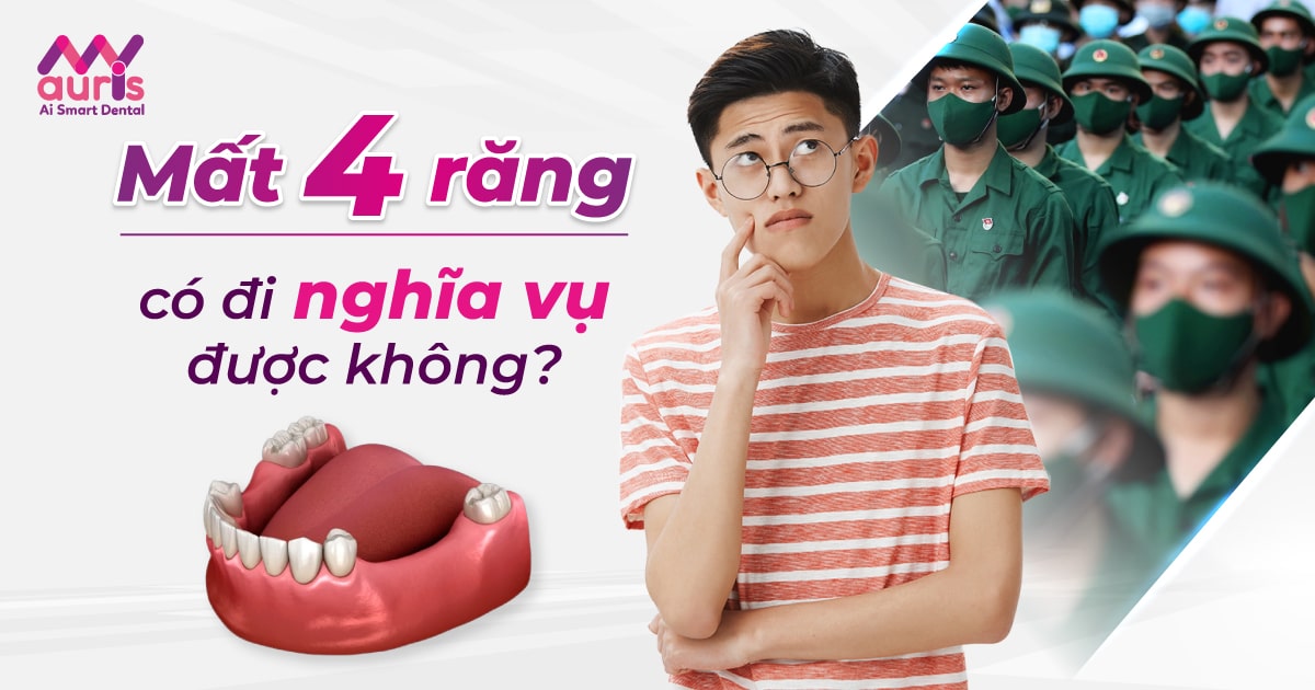 Mất 4 răng có đi nghĩa vụ không và cách phục hình?