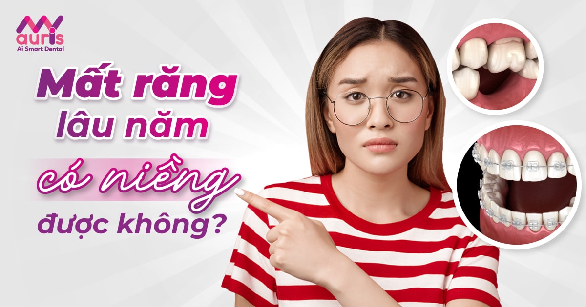 Giải đáp mất răng lâu năm có niềng được không?