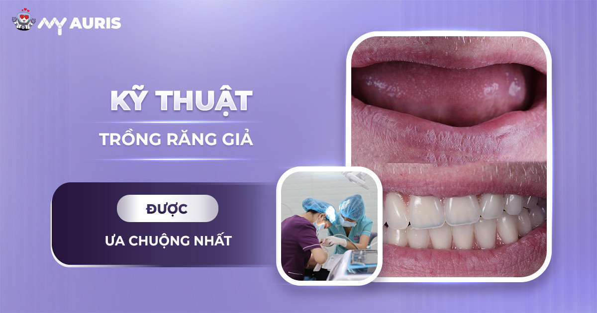 các kỹ thuật trồng răng giả,kỹ thuật trồng răng,kỹ thuật trồng răng giả