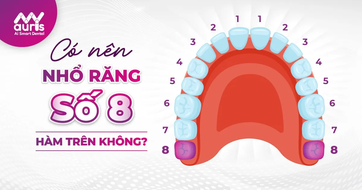 có nên nhổ răng số 8 hàm trên không?