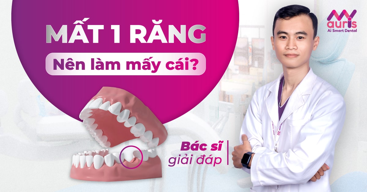 Mất 1 răng nên làm mấy cái? Bác sĩ My Auris giải đáp