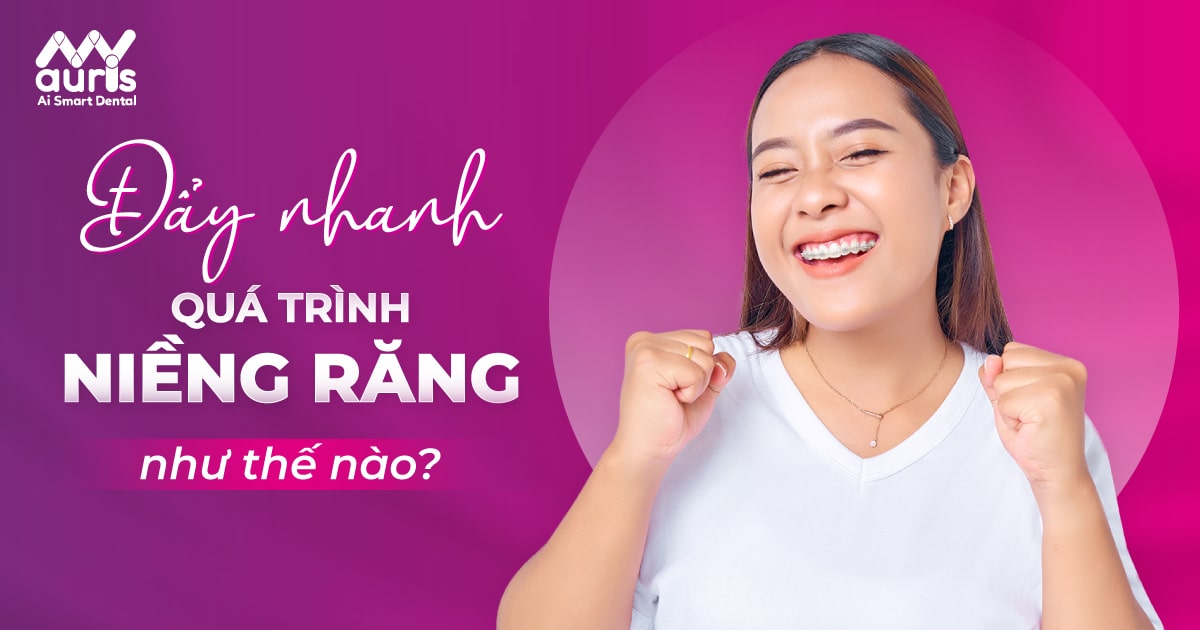 [Cập nhật] 7 mẹo giúp đẩy nhanh quá trình niềng răng