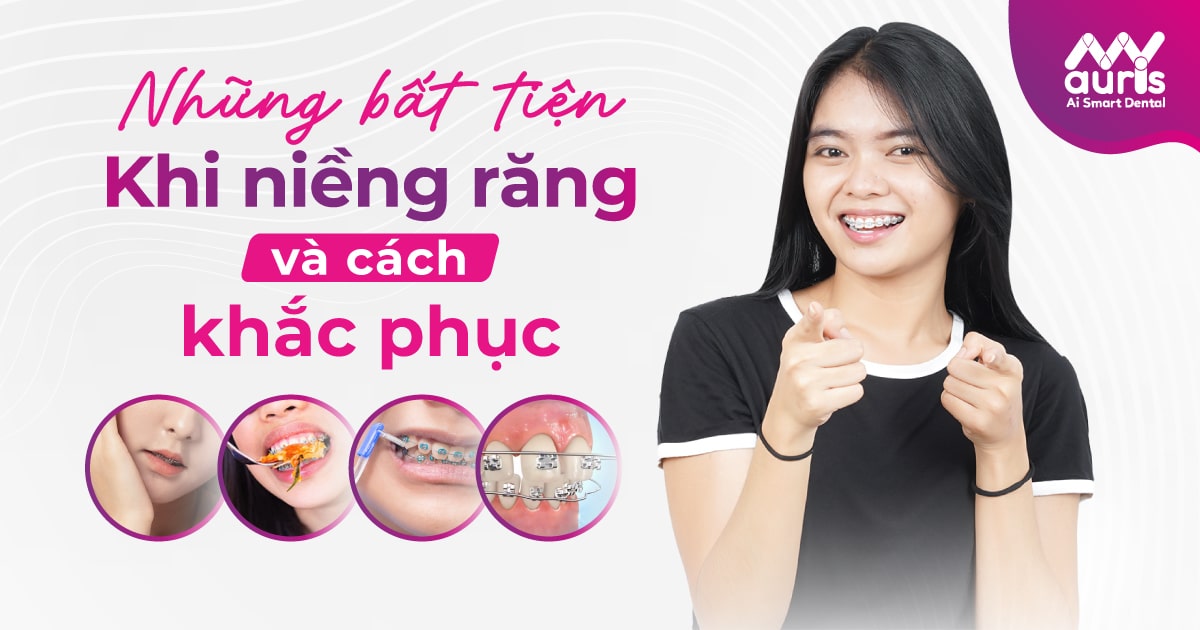 Những bất tiện khi niềng răng