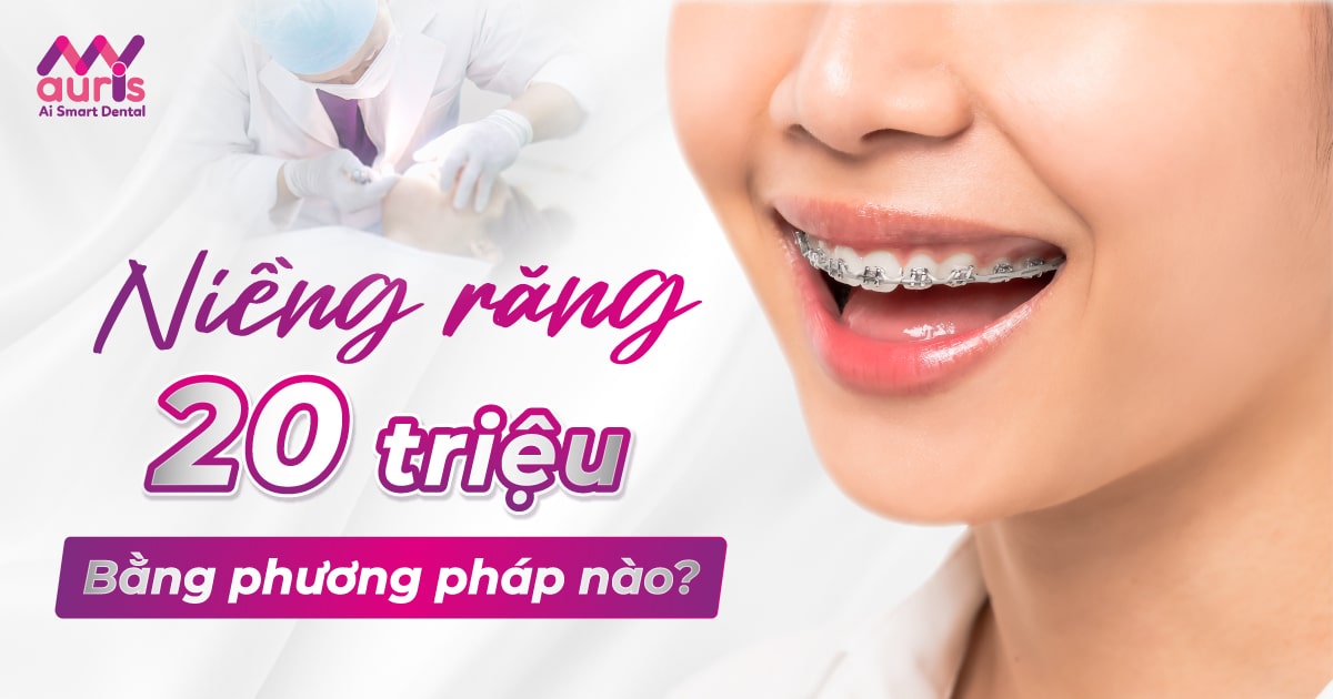 Niềng răng 20 triệu