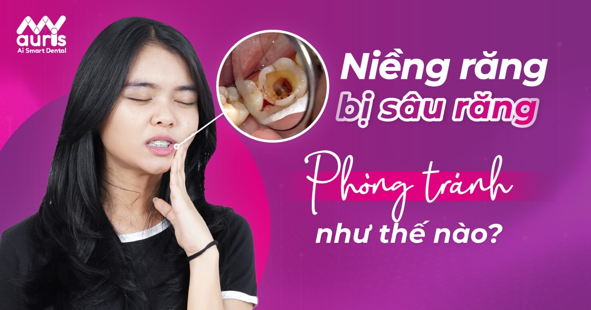 Niềng răng bị sâu răng nên phòng tránh như thế nào?