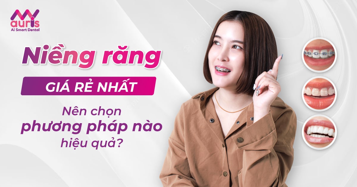 Niềng răng giá rẻ nhất