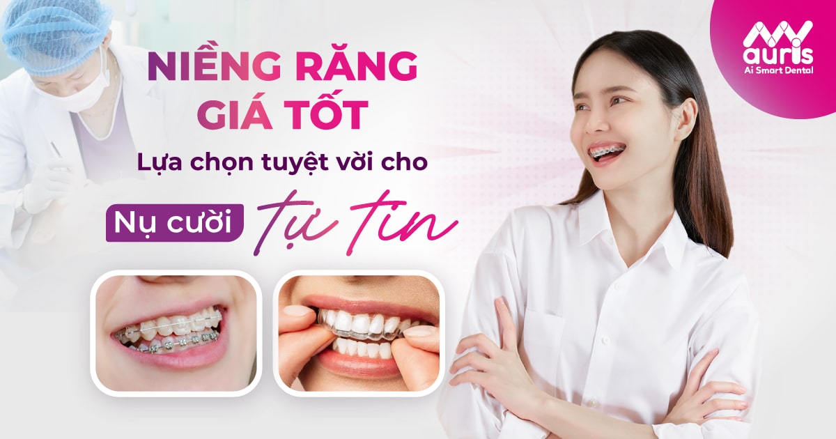 Niềng răng giá tốt