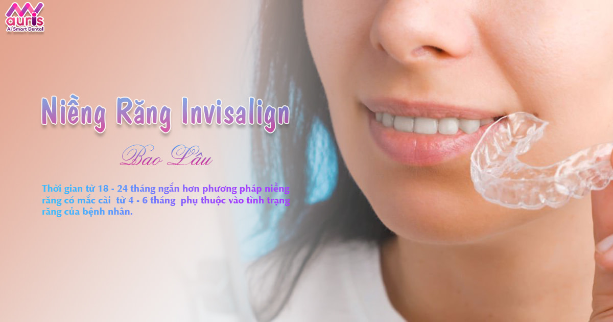 Loại răng của mình có ảnh hưởng đến thời gian niềng răng Invisalign mất bao lâu không?
