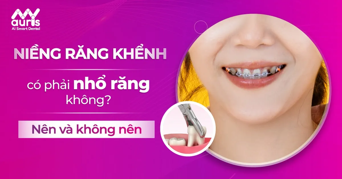 Niềng răng khểnh có phải nhổ răng không?