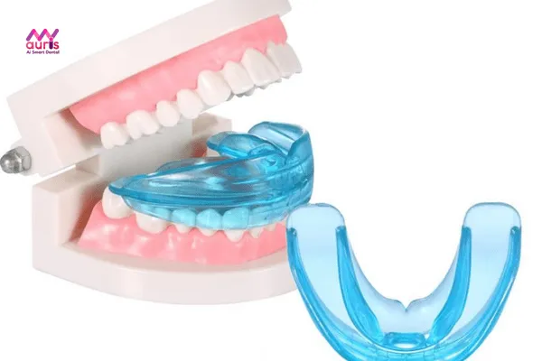 Đặc điểm của niềng răng nhựa cho trẻ em 