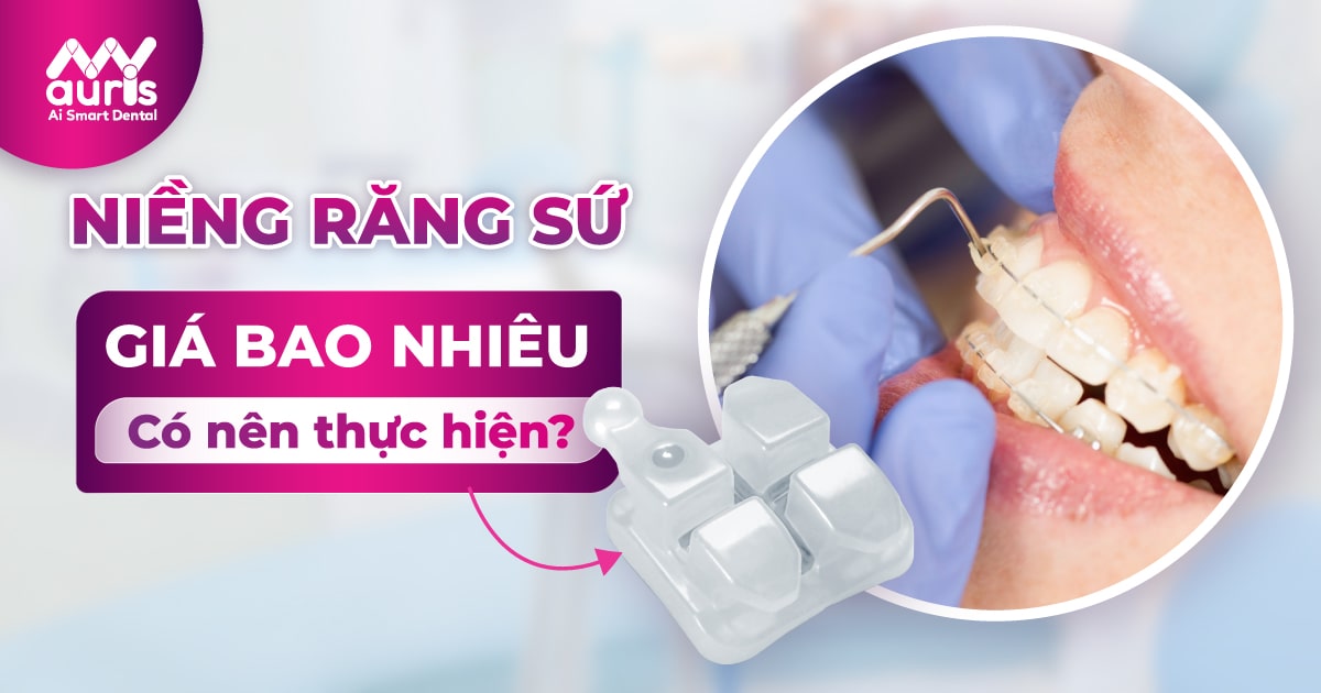 Niềng răng sứ giá bao nhiêu