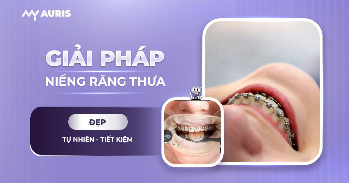 niềng răng thưa,các giai đoạn niềng răng thưa,cách niềng răng thưa,niềng răng cho răng thưa,quá trình niềng răng thưa,quy trình niềng răng thưa,răng thưa có niềng răng được không,thời gian niềng răng thưa