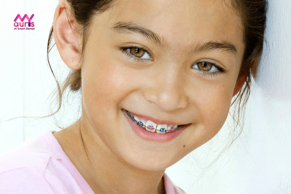 Độ tuổi niềng răng, trẻ em từ 6-12 tuổi chỉnh nha có thời gian ngắn hơn so với người trưởng thành 