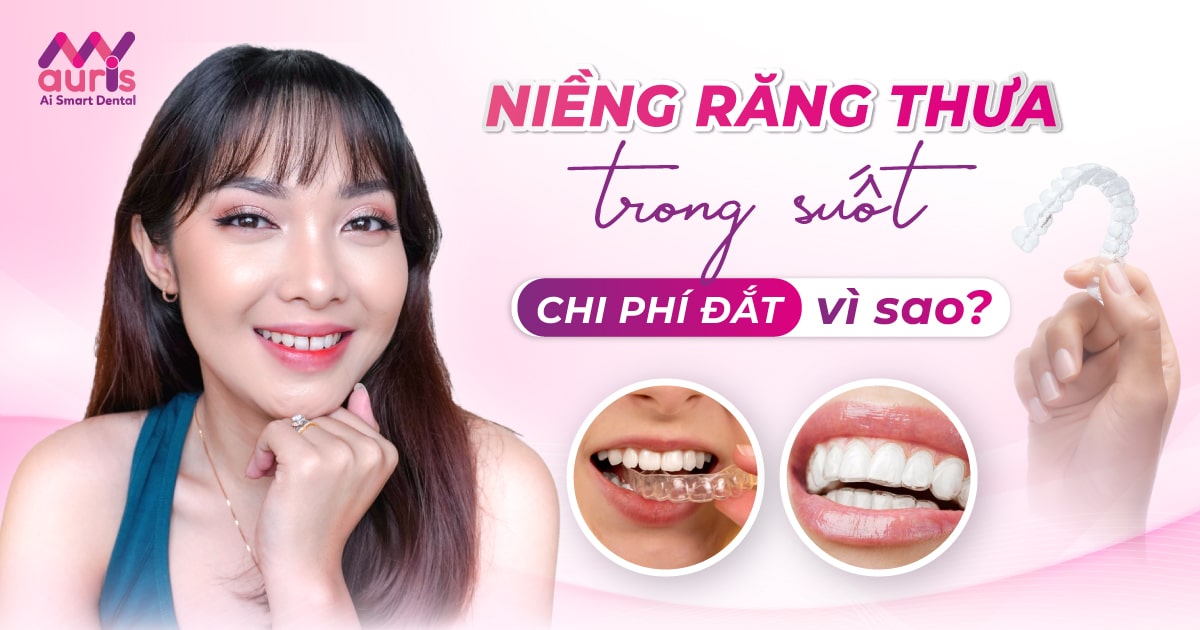 Niềng răng thưa trong suốt - 4 lý do khiến chi phí đắt