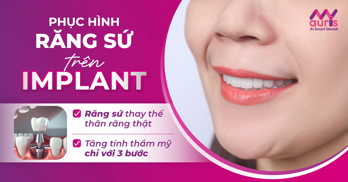 Phục hình răng sứ trên implant