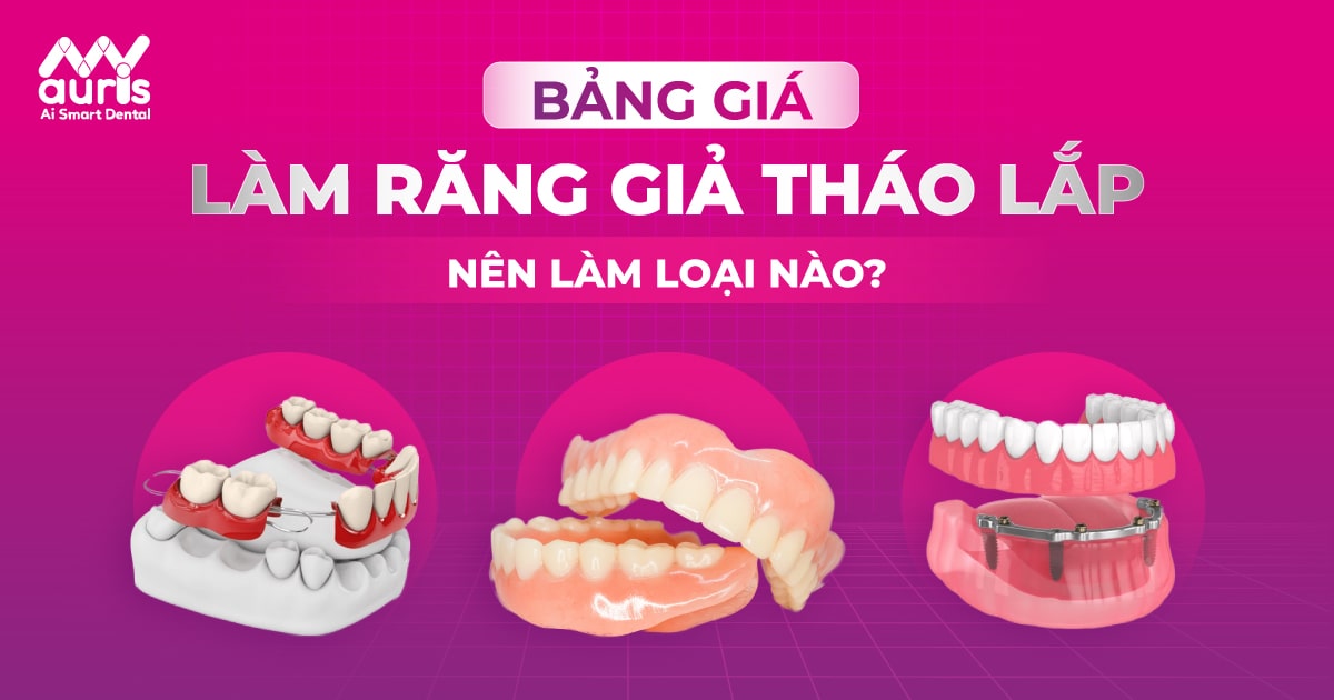 Bảng giá làm răng giả tháo lắp và nên thực hiện loại nào?