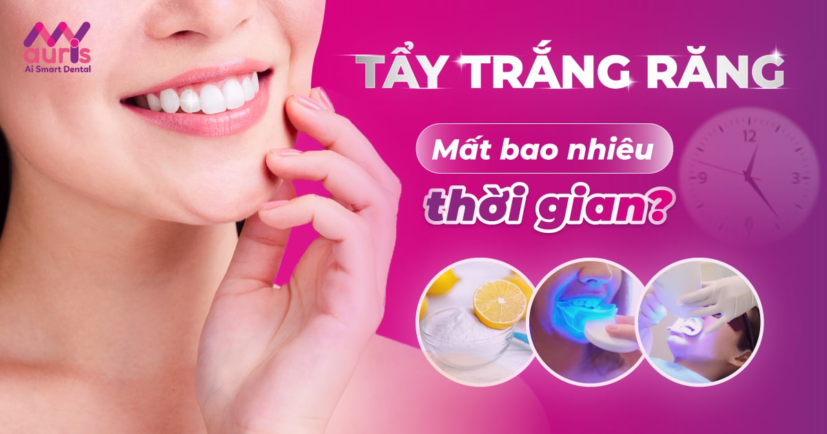 Tìm hiểu tẩy trắng răng mất bao nhiêu thời gian?