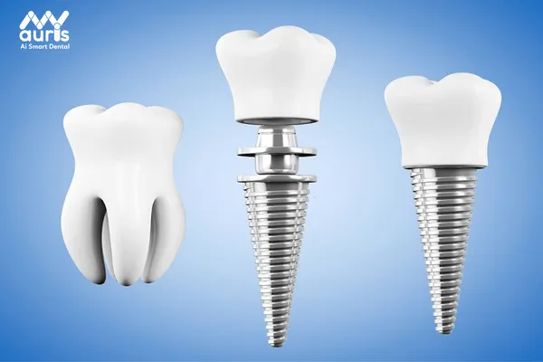 Trồng răng Implant tại TPHCM phải có giấy phép hoạt động