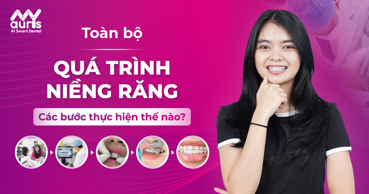 Toàn bộ quá trình niềng răng